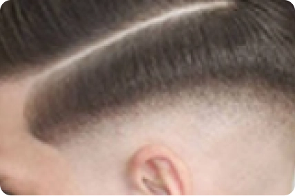 Undercut